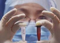 北京再现H7N9禽流感病例 由河北入京救治