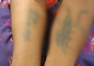 印度女子结婚没嫁妆遭夫家轮奸 身上被刺脏话