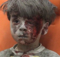 空袭中幸存：叙利亚男童眼神懵懂 令人心碎