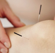 我国针灸临床研究首登国际内科学“第一刊”