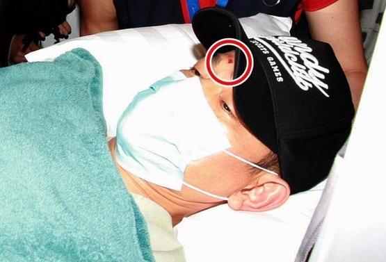 刘德华返港眉心有伤 朱丽倩低调陪护