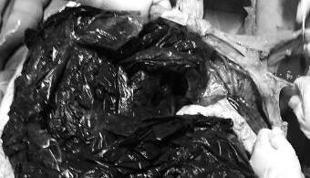 泰一座头鲸吞80余个塑料袋死亡