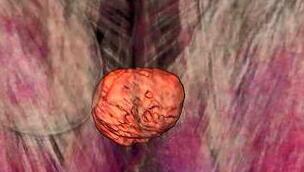 寄生虫如何操纵蚂蚁大脑？科学家首次真实观察到了