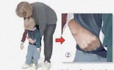 男童龙眼卡喉口鼻流血危急时刻这个方法救了他