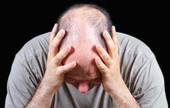 大龄的你开始秃顶了吗？科研研究让脱发问题有望逆转