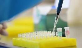 大连全民核酸检查发现更多无症状感染者