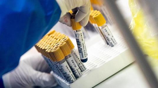 国家卫健委：4日新增新冠肺炎确诊病例85例 其中本土病例62例