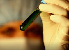 巴西全国灭蚊 “寨卡疫情不会影响到里约奥运会”