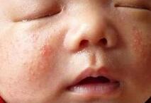 强生公司婴儿爽身粉含滑石粉可致癌