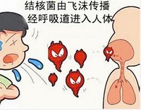 关于肺结核的七个问题 你知道多少？
