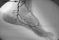 日常小动作帮助脚部保健