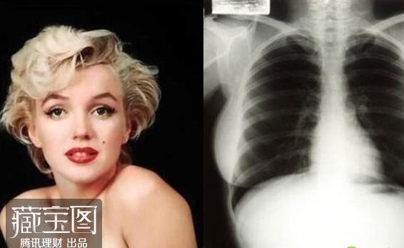 你想不到的另类拍卖！梦露X光胸片拍出4.5万美元