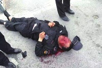 殴打保安：致使保安满脸是血 眼睛受伤严重