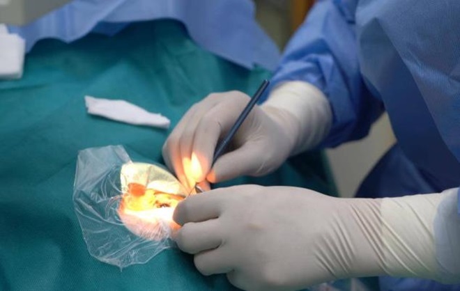 光学区突破7.6毫米，武汉完成华中首例EVO+ ICL（V5）晶体植入术