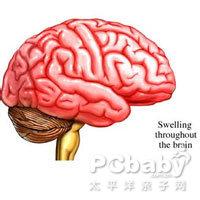 老人被蚊叮患上乙脑 连续5天高烧