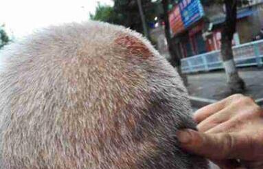 女司机遭奇葩碰瓷：男子将头部血迹抹车头要钱