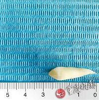 美女眼眶下面长牙 差点&ldquo;咬破&rdquo;眼球(图)