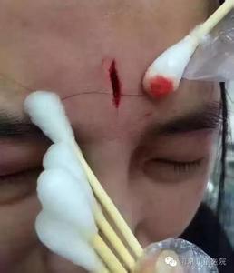 南京护士没能一针见血被患儿母砸伤 警方调查