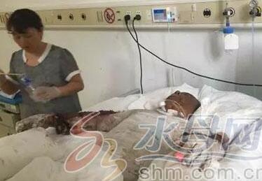 男子半夜拔充电器引爆燃气 瞬间被烧成&ldquo;血人&rdquo;