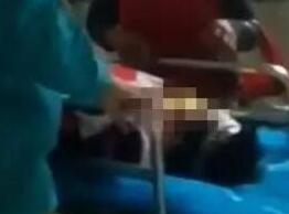 2岁男孩被洗澡水烫伤 爷爷奶奶土方治疗致休克