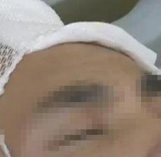 因上门慢，两快递员被砖头砸进医院