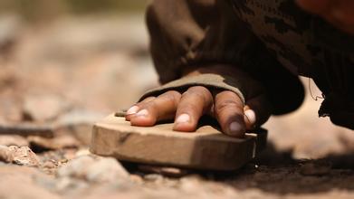 沈阳老太换上&ldquo;3D髋关节&rdquo;