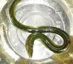 男子腹痛从中取出黄鳝 医生:或从肛门进入(图)